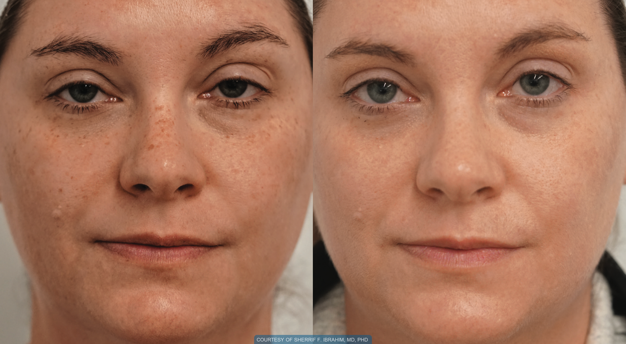 before-and-after-4