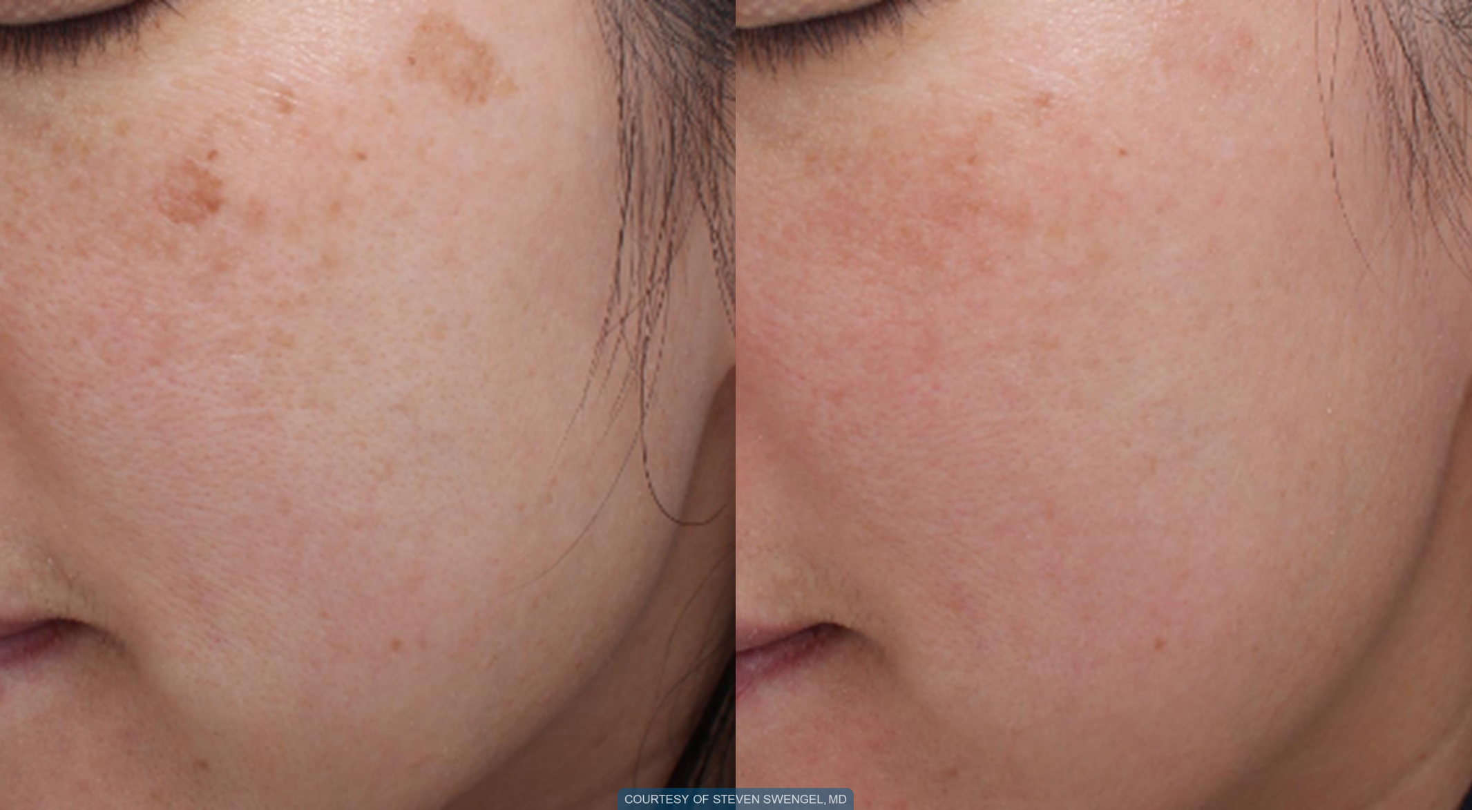 before-and-after-5