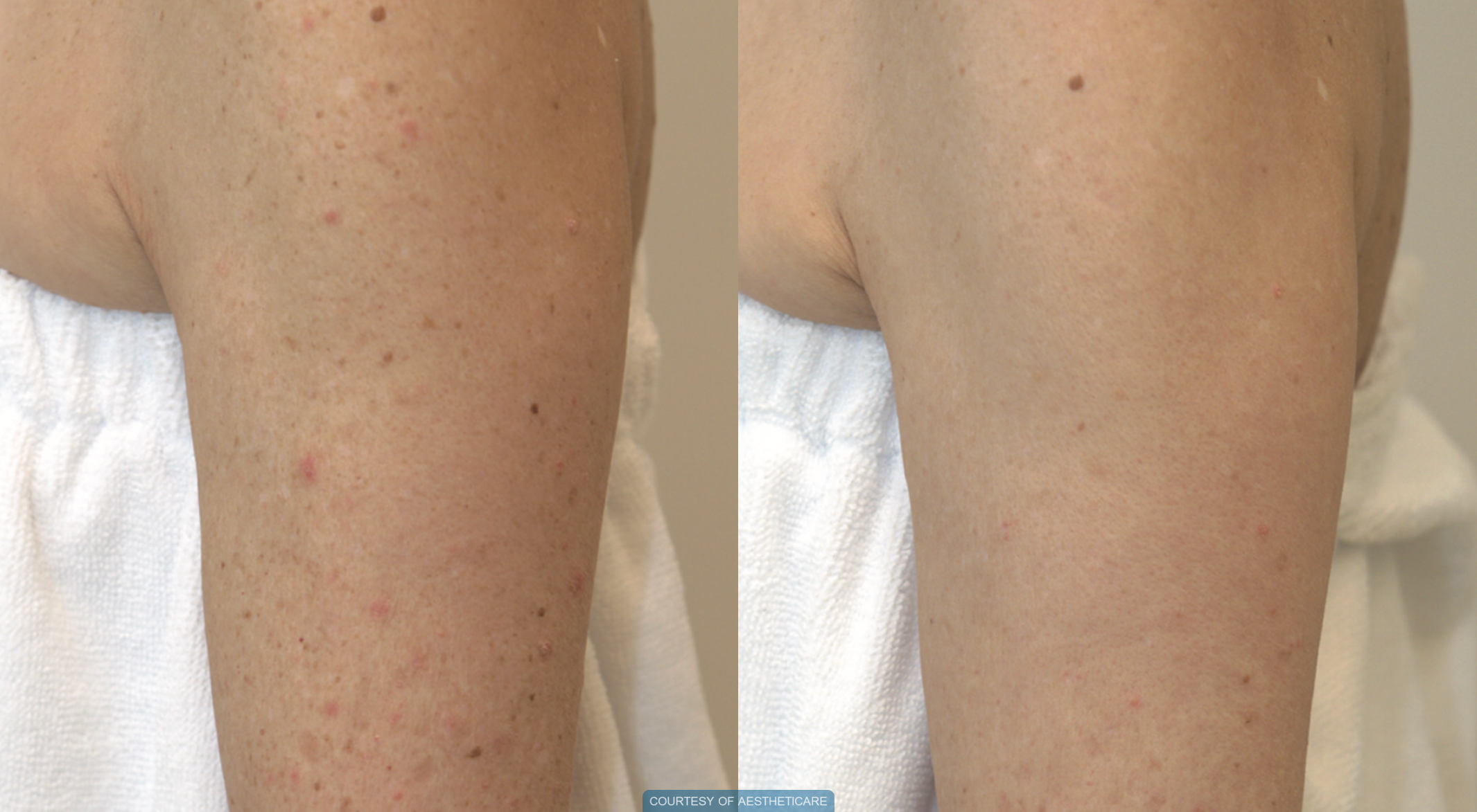 before-and-after-6