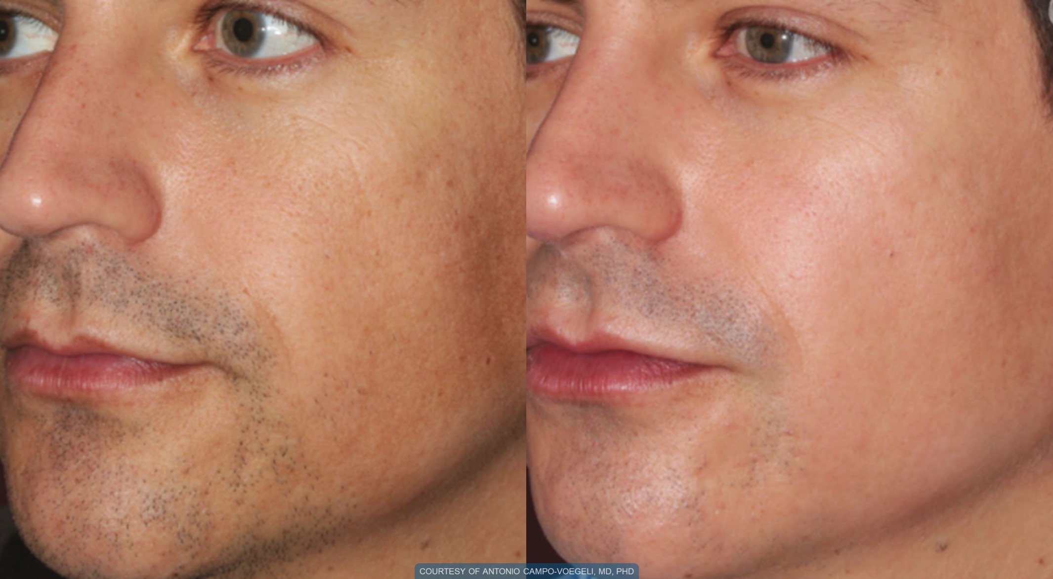 men-before-and-after-1