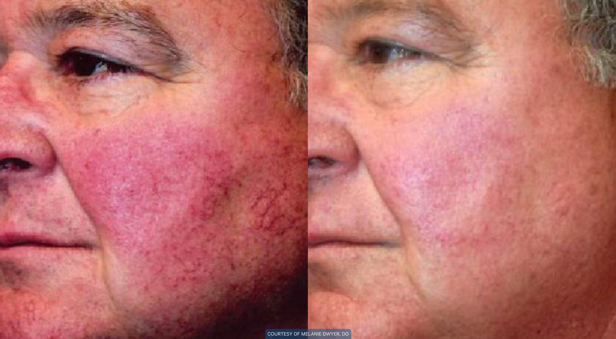 men-before-and-after-2