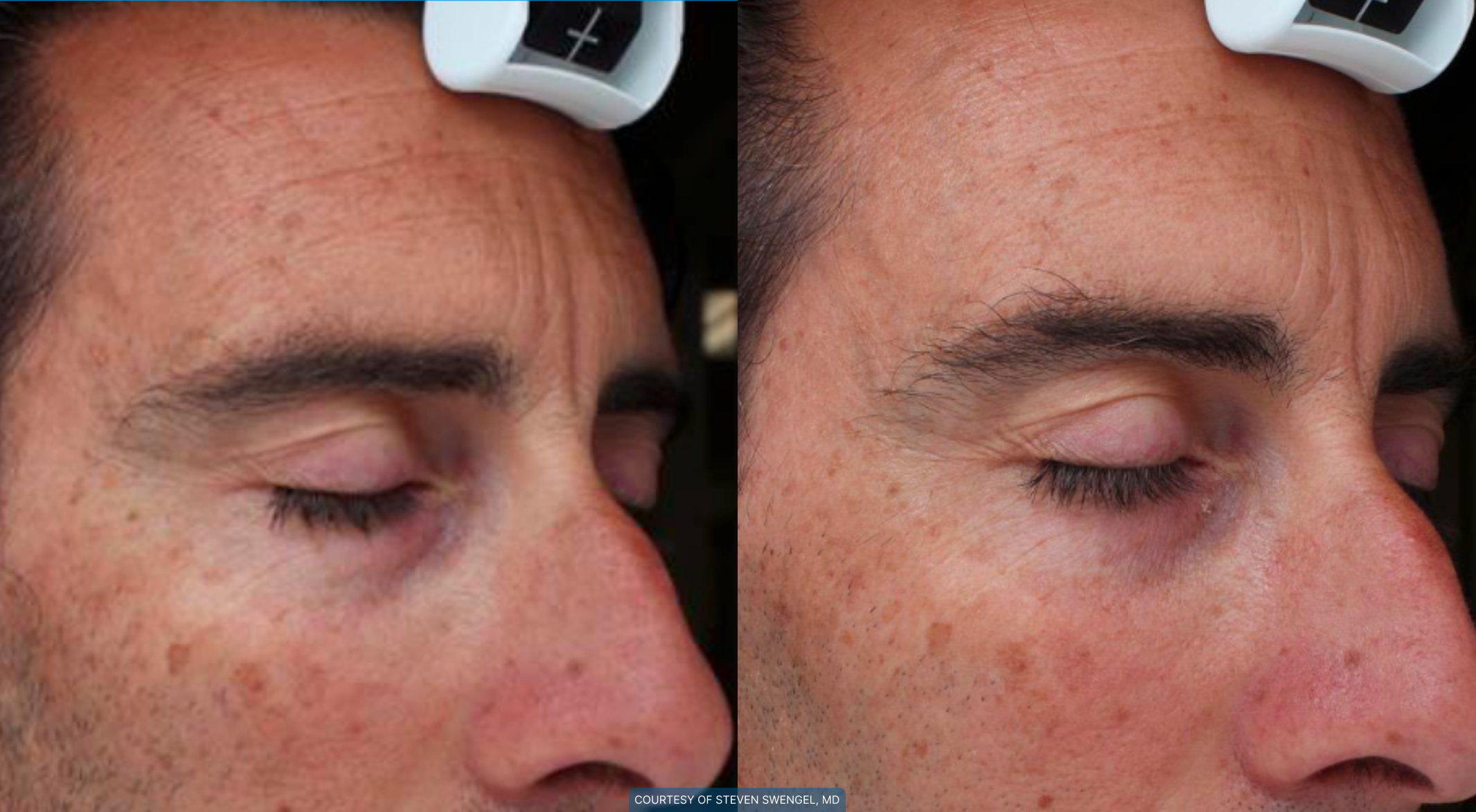 men-before-and-after-3