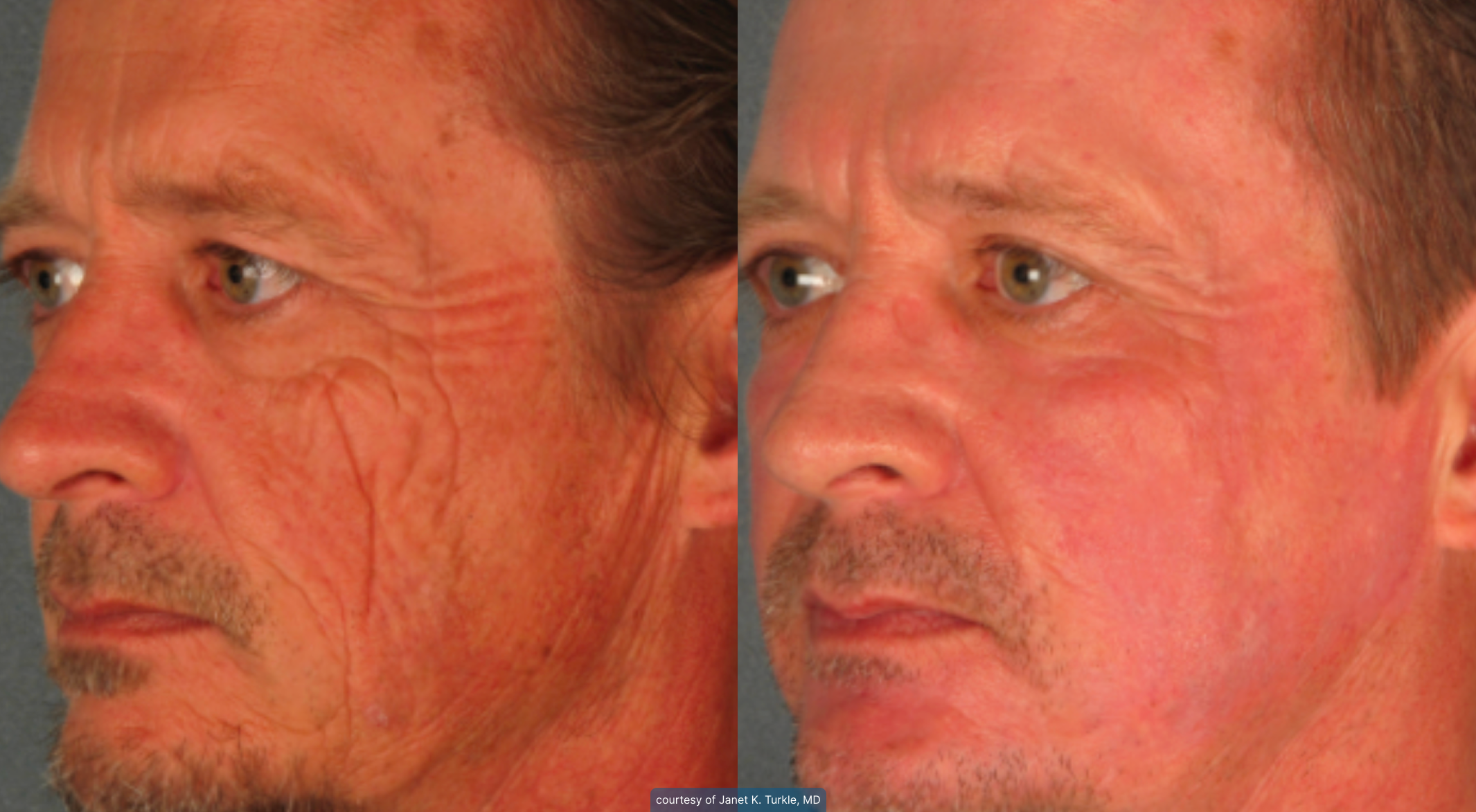 men-before-and-after-4